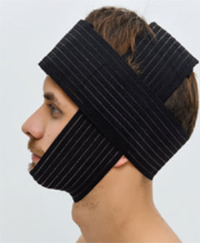 Steznik nakon facelifting-a 02