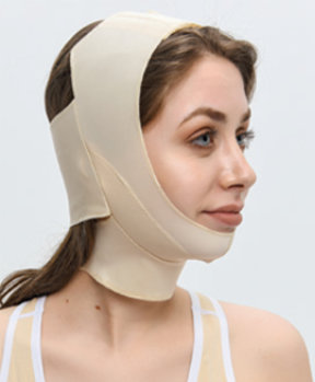 Steznik nakon facelifting-a 04