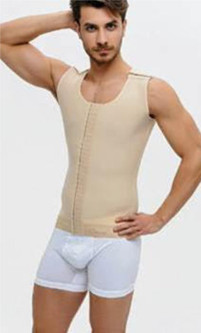 Steznik nakon ginekomastije